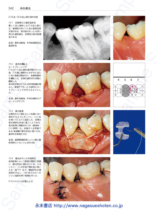 ラタイチャーク カラーアトラス歯周病学 第3版: 永末書店